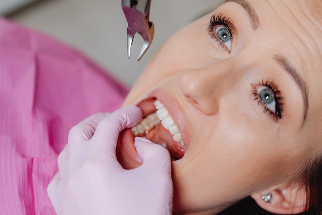 tooth extractions